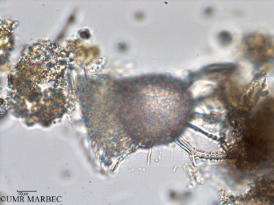 phyto/Bizerte/bizerte_bay/RISCO February 2015/Ornithocercus magnificus (ancien Baie_T5-C1-Ornithocercus-13).tif(copy)_thumb.jpg